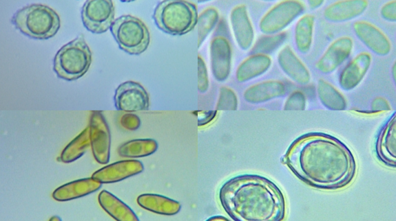 Fungal spore images from wild summer mushroom species collected in western Michigan, USA