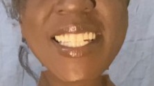 mouth
